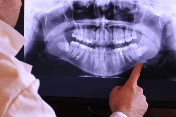 Best Weekend Emergency Dentist in Little Round Lake, WI