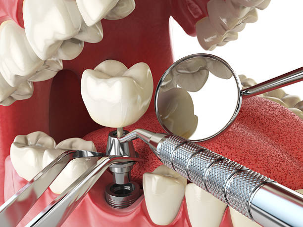 Best Broken or Cracked Tooth Emergency Dentist in Little Round Lake, WI
